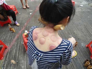 Chinese_Math_and_Science_Acupuncture